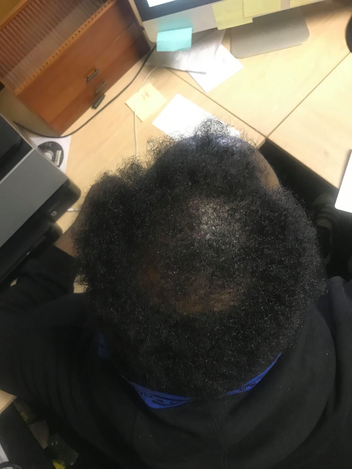 #1 Top Seller Lov3Yourz Loc Oil 🥥💧✨ 8oz